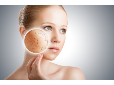 ОБЕЗВОЖЕННАЯ КОЖА: ПОЧЕМУ КРЕМ НЕ РАБОТАЕТ И ЧТО ДЕЛАТЬ НА САМОМ ДЕЛЕ ОБЕЗВОЖЕННАЯ КОЖА: ПОЧЕМУ КРЕМ НЕ РАБОТАЕТ И ЧТО ДЕЛАТЬ НА САМОМ ДЕЛЕ