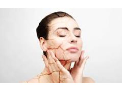 ОБЕЗВОЖЕННАЯ КОЖА: ПОЧЕМУ КРЕМ НЕ РАБОТАЕТ И ЧТО ДЕЛАТЬ НА САМОМ ДЕЛЕ ОБЕЗВОЖЕННАЯ КОЖА: ПОЧЕМУ КРЕМ НЕ РАБОТАЕТ И ЧТО ДЕЛАТЬ НА САМОМ ДЕЛЕ